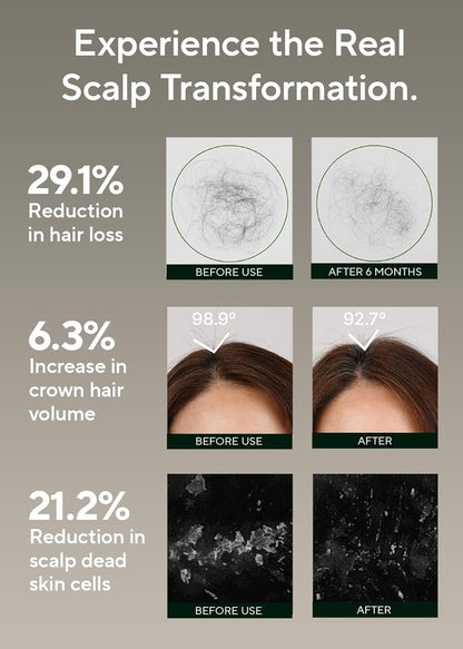 AROMATICA Rosemary Salt Scrub Shampoo - Hair Loss Korean Scalp Detox Shampoo with Rosemary Scalp Oil | Scalp Exfoliator with Salt Scrub for Oily Scalp | Sulfate Free, Silicone Free (10.5 oz / 300g)